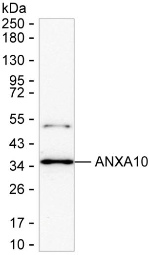 ANXA10